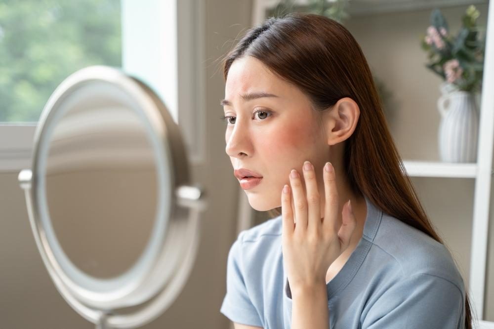 Việc chăm sóc da nhạy cảm mùa đông trở thành một trong những vấn đề được nhiều người quan tâm nhằm giữ làn da luôn khỏe mạnh