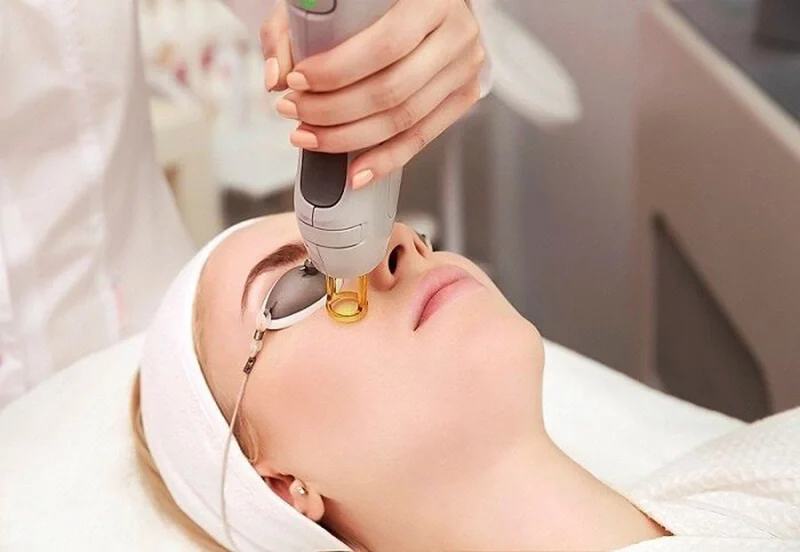 Trẻ hóa da bằng laser phù hợp với những người có dấu hiệu lão hóa như nếp nhăn nhỏ, da sạm nám, lỗ chân lông to