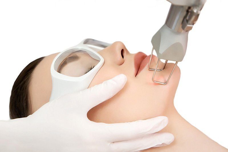 Trẻ hóa da bằng laser là một phương pháp sử dụng công nghệ ánh sáng laser để kích thích quá trình tái tạo da và phục hồi các tổn thương trên bề mặt da.