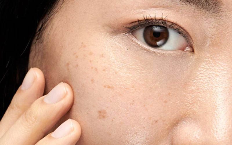 Dù trị nám bằng lá trầu là phương pháp tự nhiên hữu ích, người dùng nên lưu ý vài điểm để tránh tác dụng phụ và phát huy tối đa hiệu quả