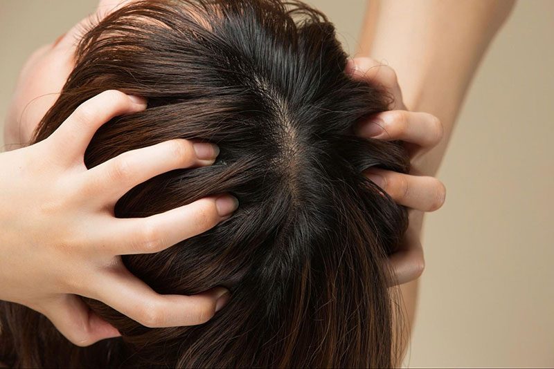 Massage da đầu giúp giảm rụng tóc chỉ hiệu quả khi bạn biết kết hợp với một chế độ dinh dưỡng hợp lý và sinh hoạt khoa học
