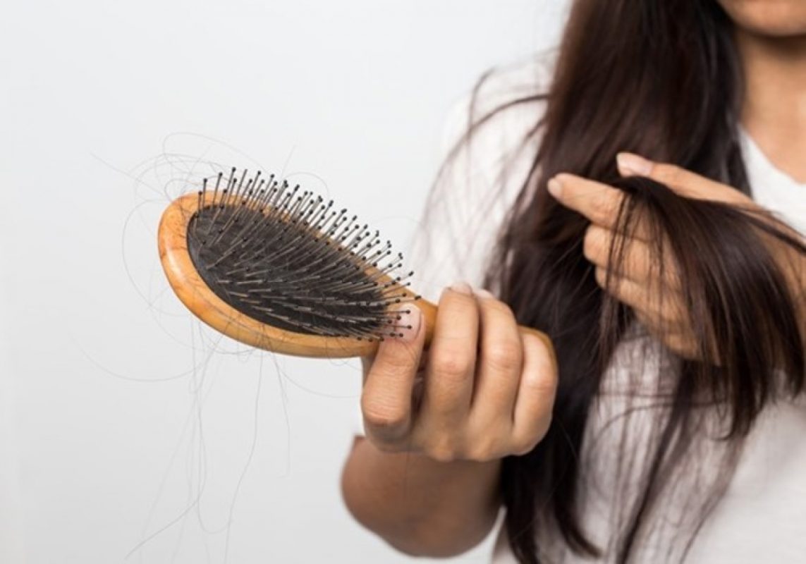 nhận biết đúng nguyên nhân tóc rụng nhiều và cách khắc phục kịp thời sẽ giúp mỗi người duy trì mái tóc chắc khỏe