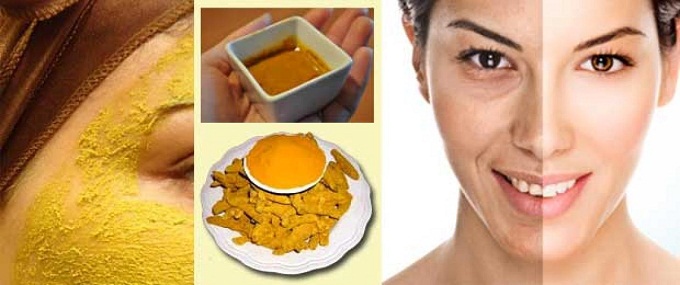 5 cách trị nám da bằng nghệ tươi đẹp không tì vết