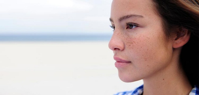 Hạnh phúc cuộc đời có khi bị mất chỉ vì mặt bị nám