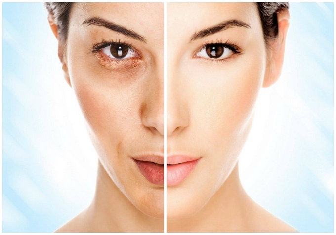 Xua tan nám da với những phương pháp tự nhiên hiệu quả