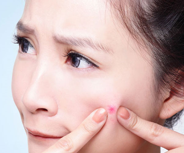 Top trái cây có thể làm da thay đổi tệ hại nhanh chóng