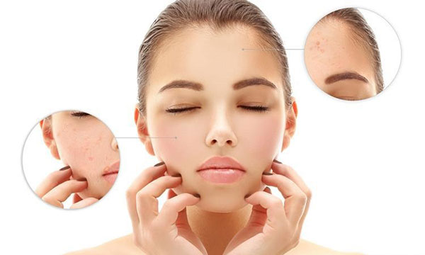 Da bị mụn bọc, mủ nên sử dụng loại sữa rửa mặt nào?