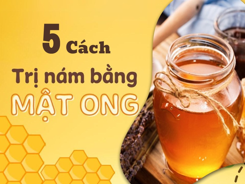 5 Cách trị nám bằng mật ong tại nhà cho da sáng mịn không tì vết
