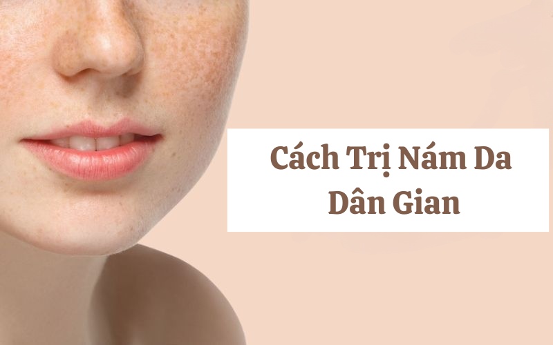 10 cách trị nám da dân gian hiệu quả dùng nguyên liệu thiên nhiên