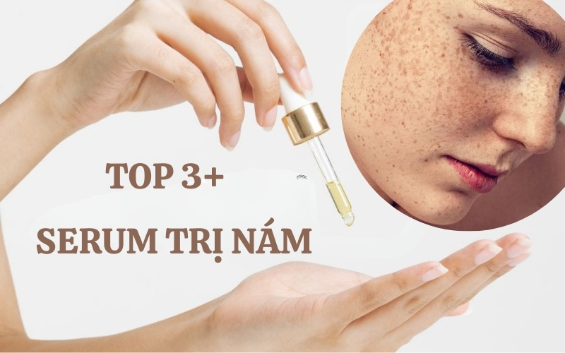 TOP 3+ serum trị nám chuyên sâu được chuyên gia khuyên dùng