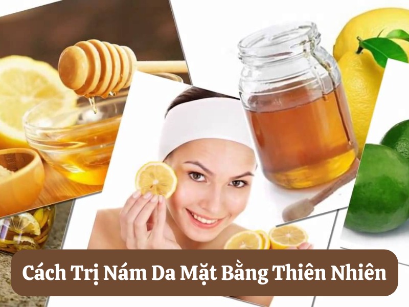 8 Cách trị nám da mặt bằng thiên nhiên bạn nên thử ngay