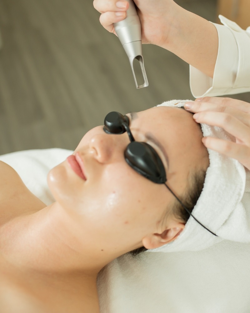 Cách chăm sóc da sau laser giúp phục hồi làn da nhanh nhất