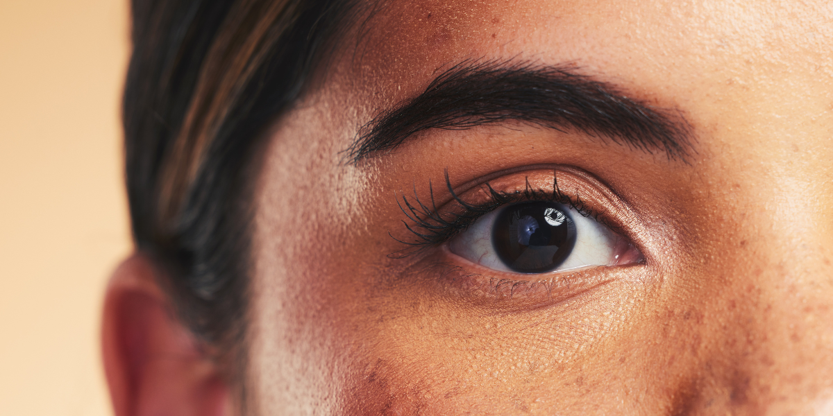 TOP 6 PHƯƠNG PHÁP TẨY NÁM DA MẶT TẠI NHÀ HIỆU QUẢ HIỆN NAY