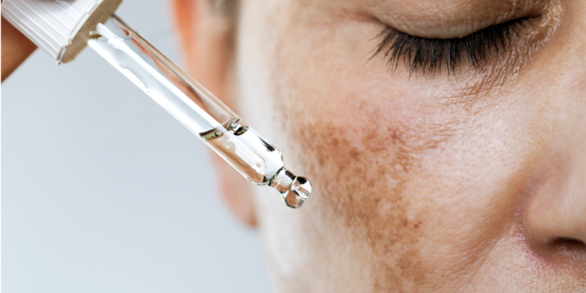 TOP 3 Ampoule cho da nám tốt nhất được chuyên gia khuyên dùng