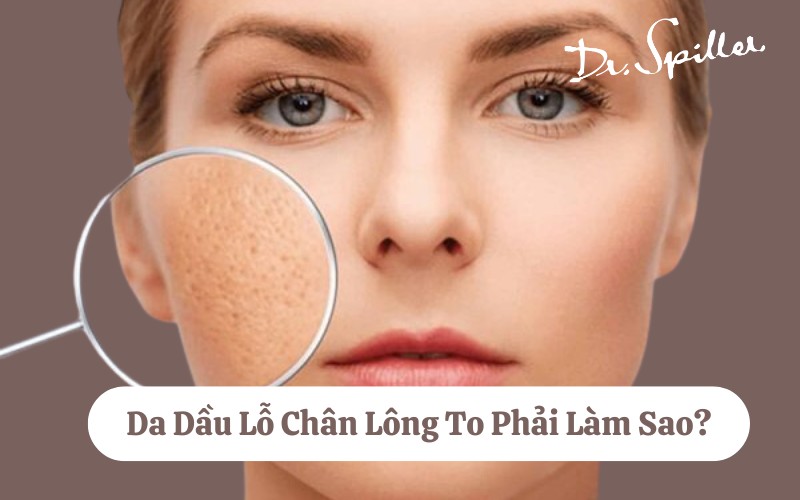 Da dầu lỗ chân lông to: Nguyên nhân và cách chăm sóc da chuẩn