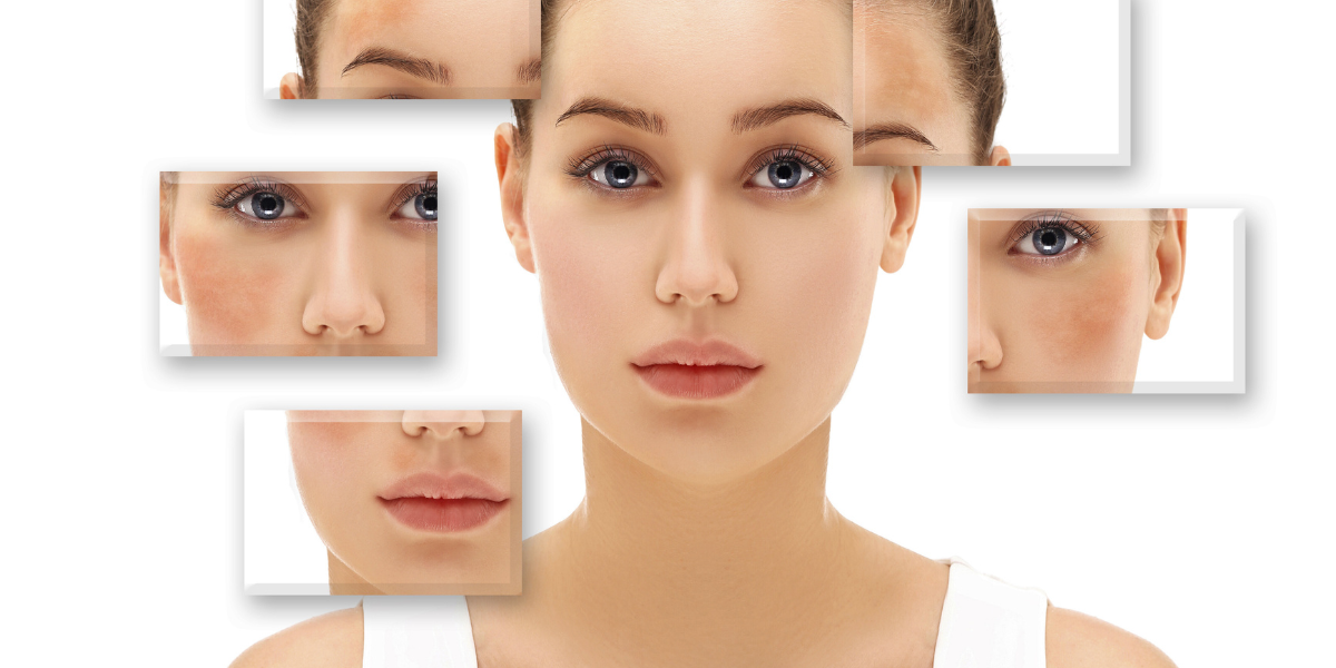 Top 3 Kem Dưỡng Ban Đêm Trị Nám Được Chị Em Tin Dùng Nhất