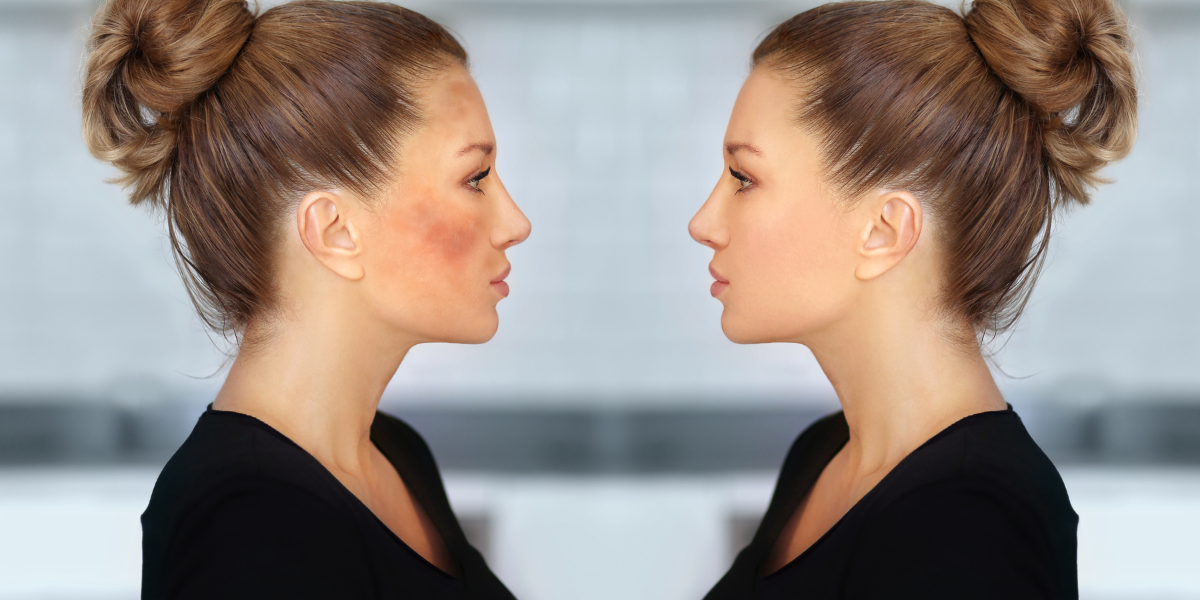 TOP 5 kem dưỡng đêm cho da nám đánh bay nám hiệu quả nhất hiện nay