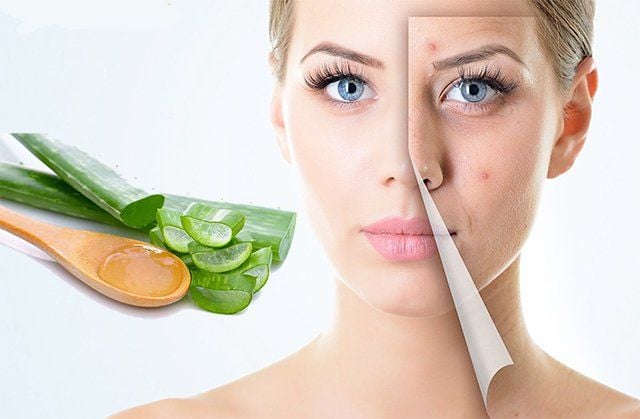 Cách trị mụn bằng nha đam giúp giảm mụn hiệu quả tại nhà