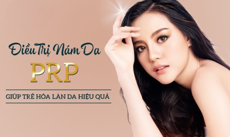 Liệu Trình Trị Nám Bằng PRP: Tái Tạo Da, Xóa Mờ Nám An Toàn