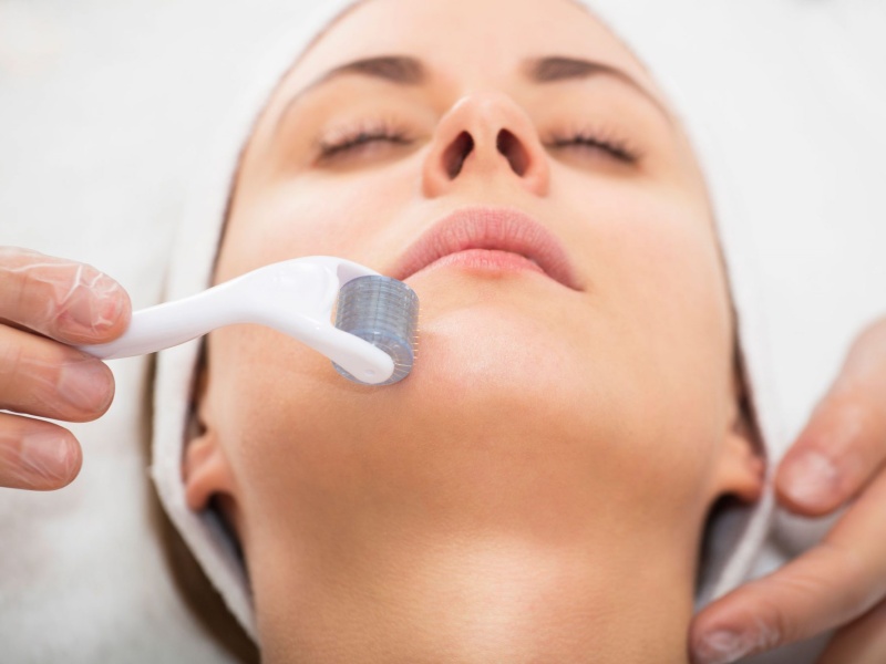 [Thông tin tham khảo] Lăn kim trị lỗ chân lông to giúp se khít da hiệu quả