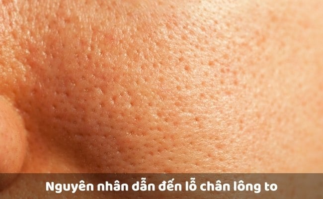 3 Giải pháp thu nhỏ lỗ chân lông to an toàn và hiệu quả