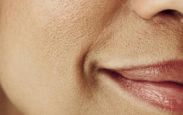 3 Giải pháp thu nhỏ lỗ chân lông to ở mặt hiệu quả, an toàn