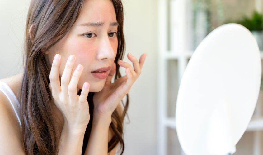 5 Cách chăm sóc da nhạy cảm bằng nguyên liệu tự nhiên an toàn