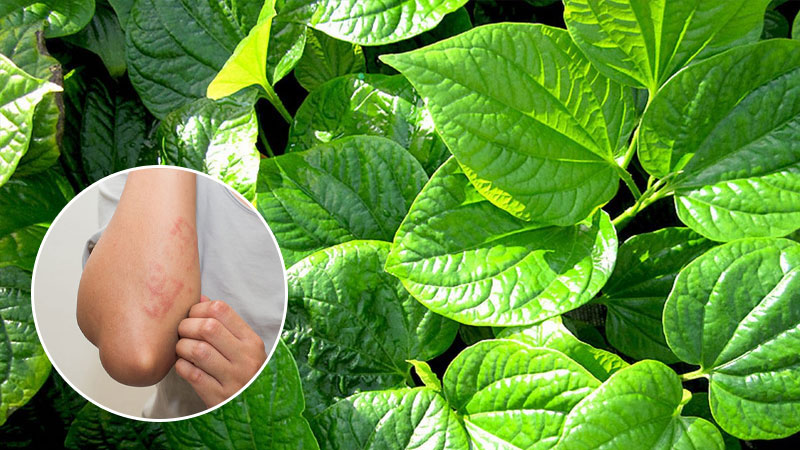 3 Cách chữa kích ứng da bằng lá trầu không đúng cách, hiệu quả