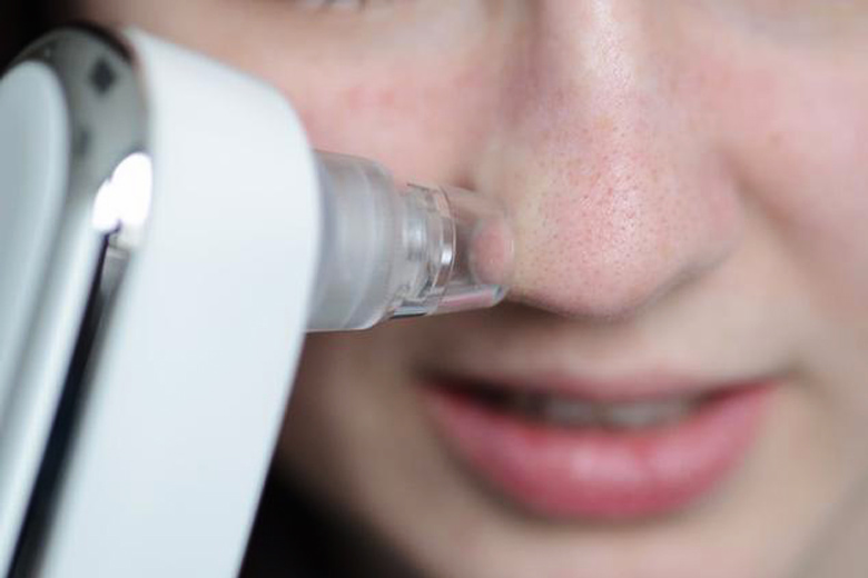 3 TIPS Hút mụn đầu đen đúng cách giúp da sạch mịn, ngừa mụn