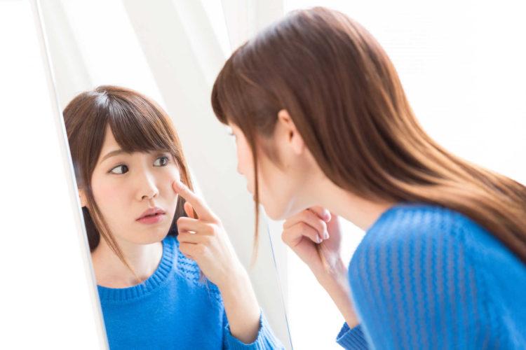 3 Cách Nặn Mụn Đầu Đen Hiệu Quả Giúp Da Sạch Mụn