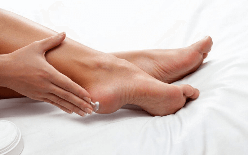 4 Giải pháp hiệu quả cho nứt gót chân mùa đông khô nứt đau rát